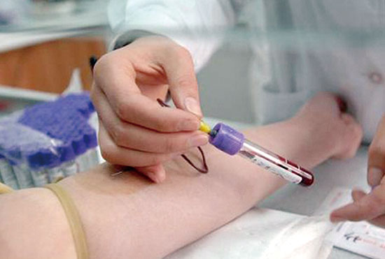 血液檢查應注意5點以及紅細胞壽命測定介紹